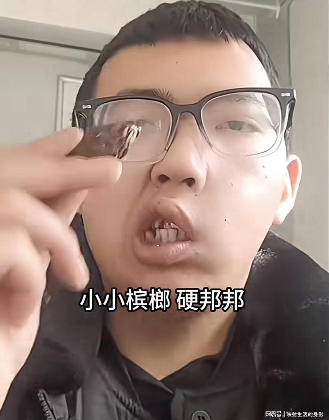 脸部变形还边嚼边劝大家别碰槟榔米乐m6网站男子嚼槟榔七年导致(图2)